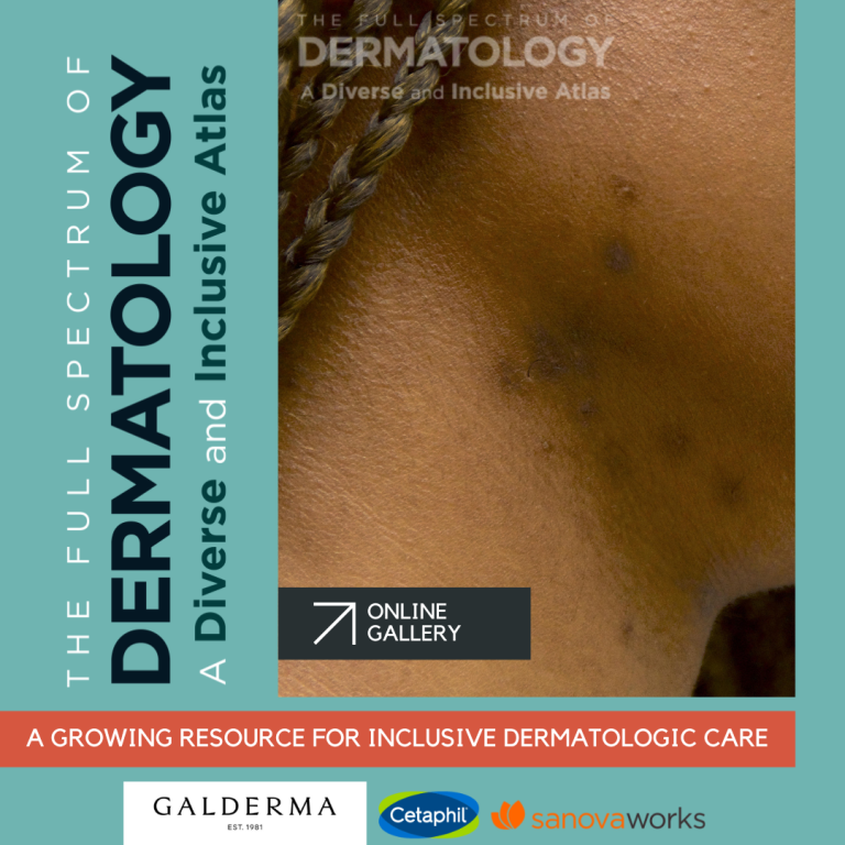 Dermatology Disparities Archives Next Steps In Dermatology