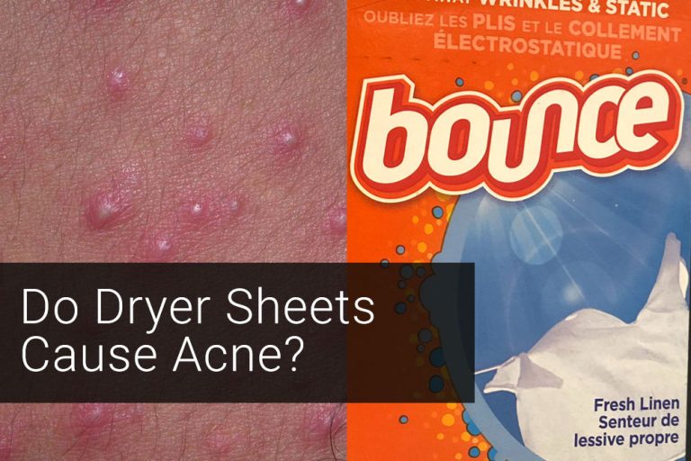 Patient Buzz Do Dryer Sheets Cause Acne? Next Steps in Dermatology