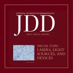 JDD Lasers Lights Sources and Devices