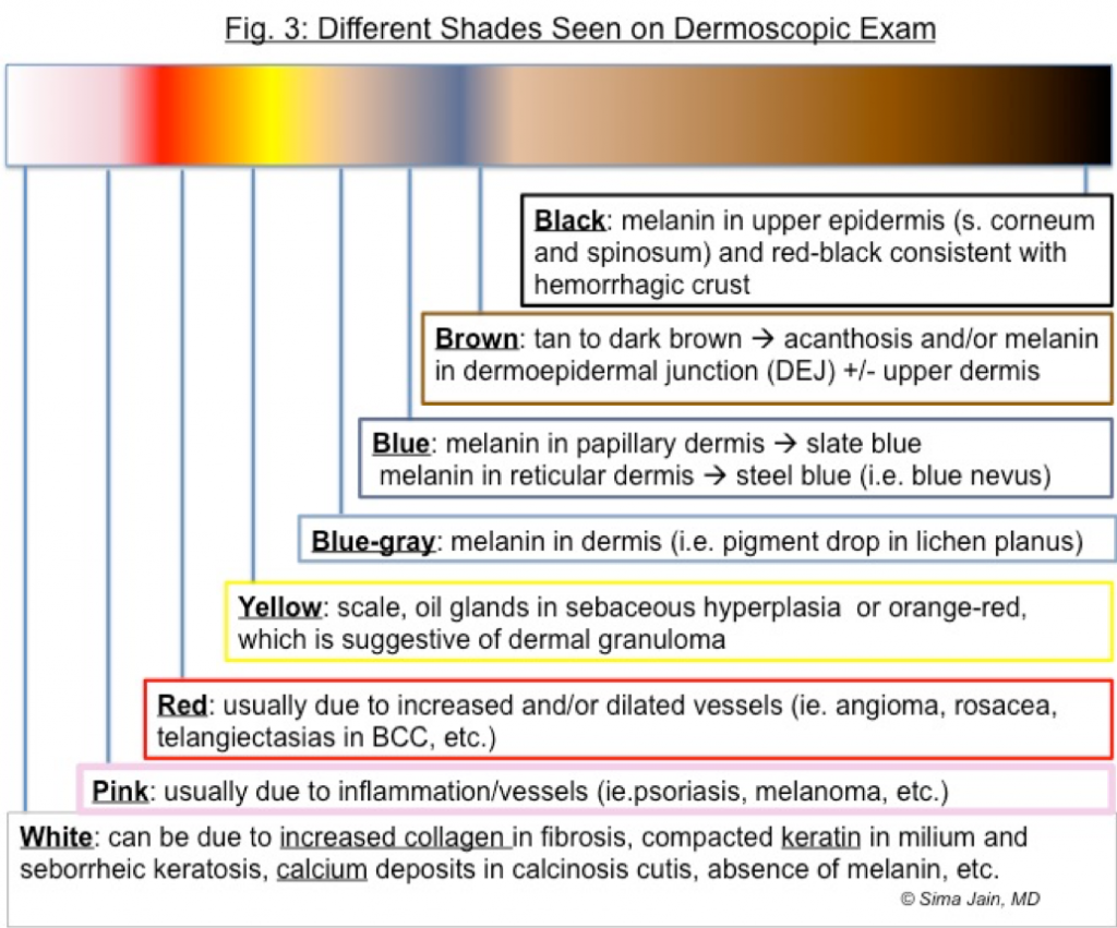 Different Shades Seen on Dermoscopic Exam