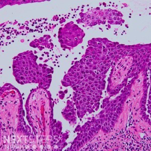 Genodermatosis