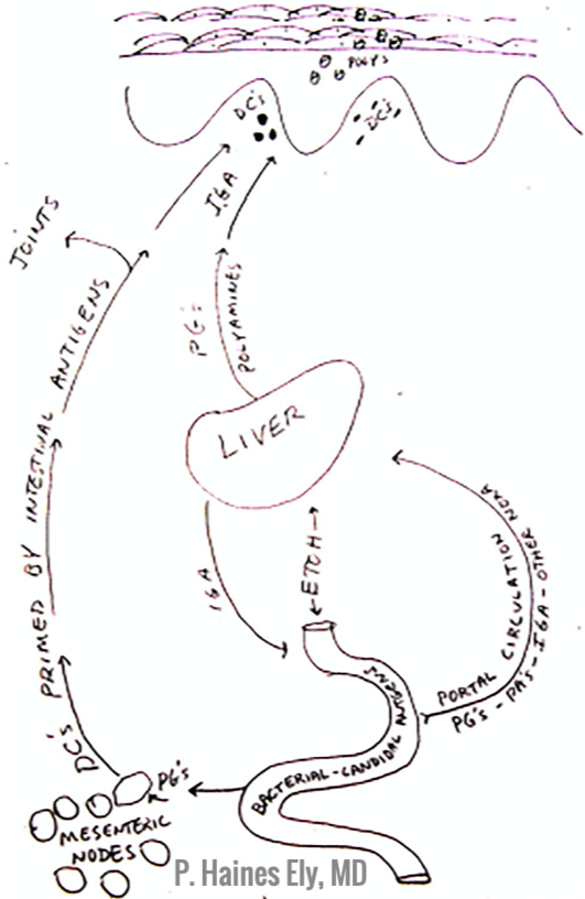 Skin Gut Axis in Psoriasis