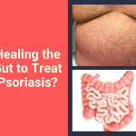 Healing the gut to treat psoriasis