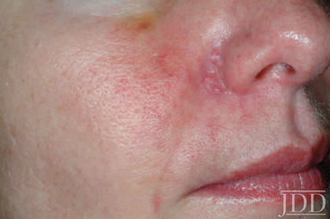 Fig4 Next Steps in Dermatology