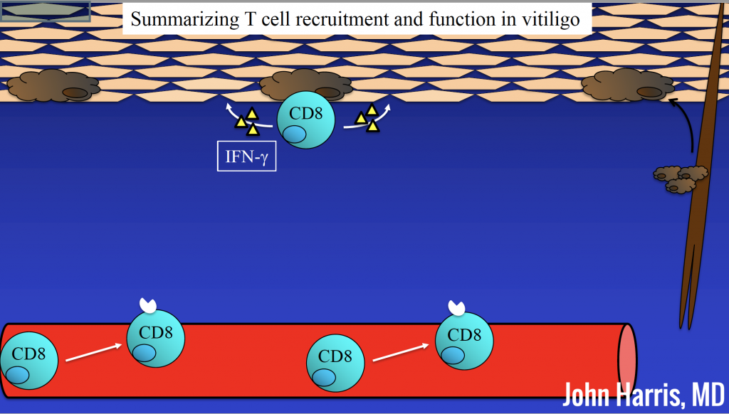 Summarizing T cell recruitment and function in vitiligo