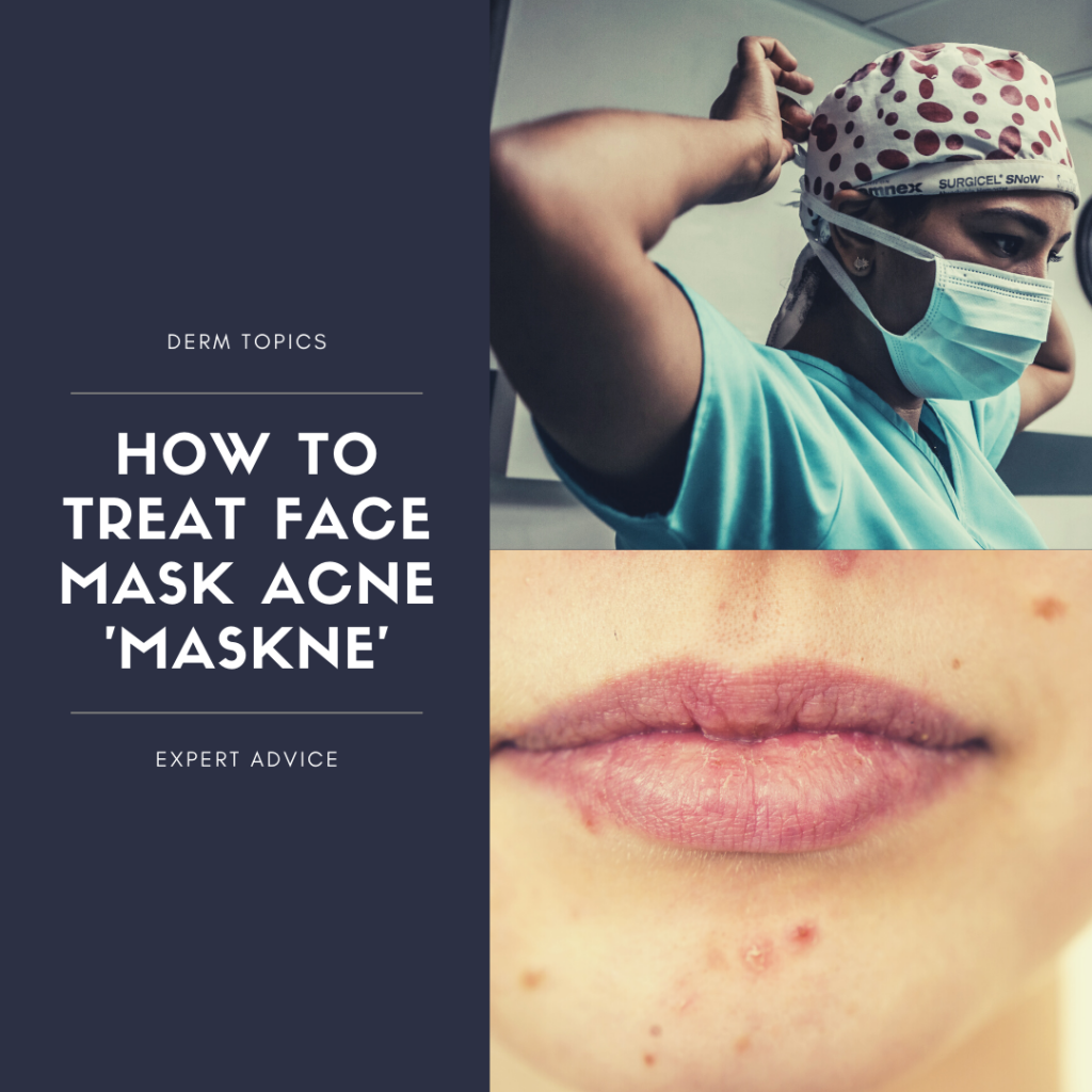 How to Treat Face Mask Acne 'Maskne' Next Steps in Dermatology