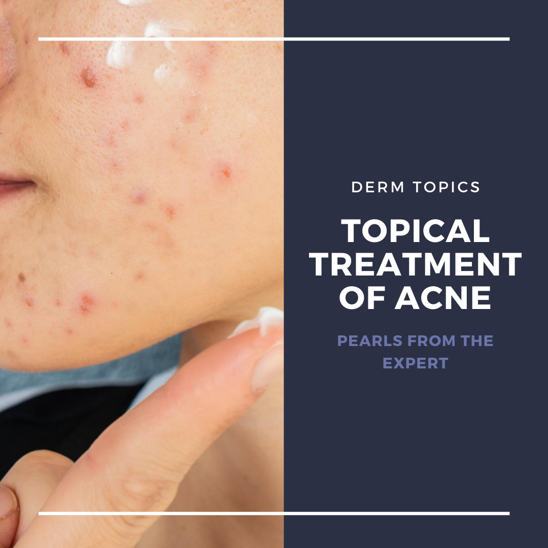 topical treatment of acne