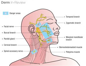 Facial nerve (CN7) branches and danger zones.