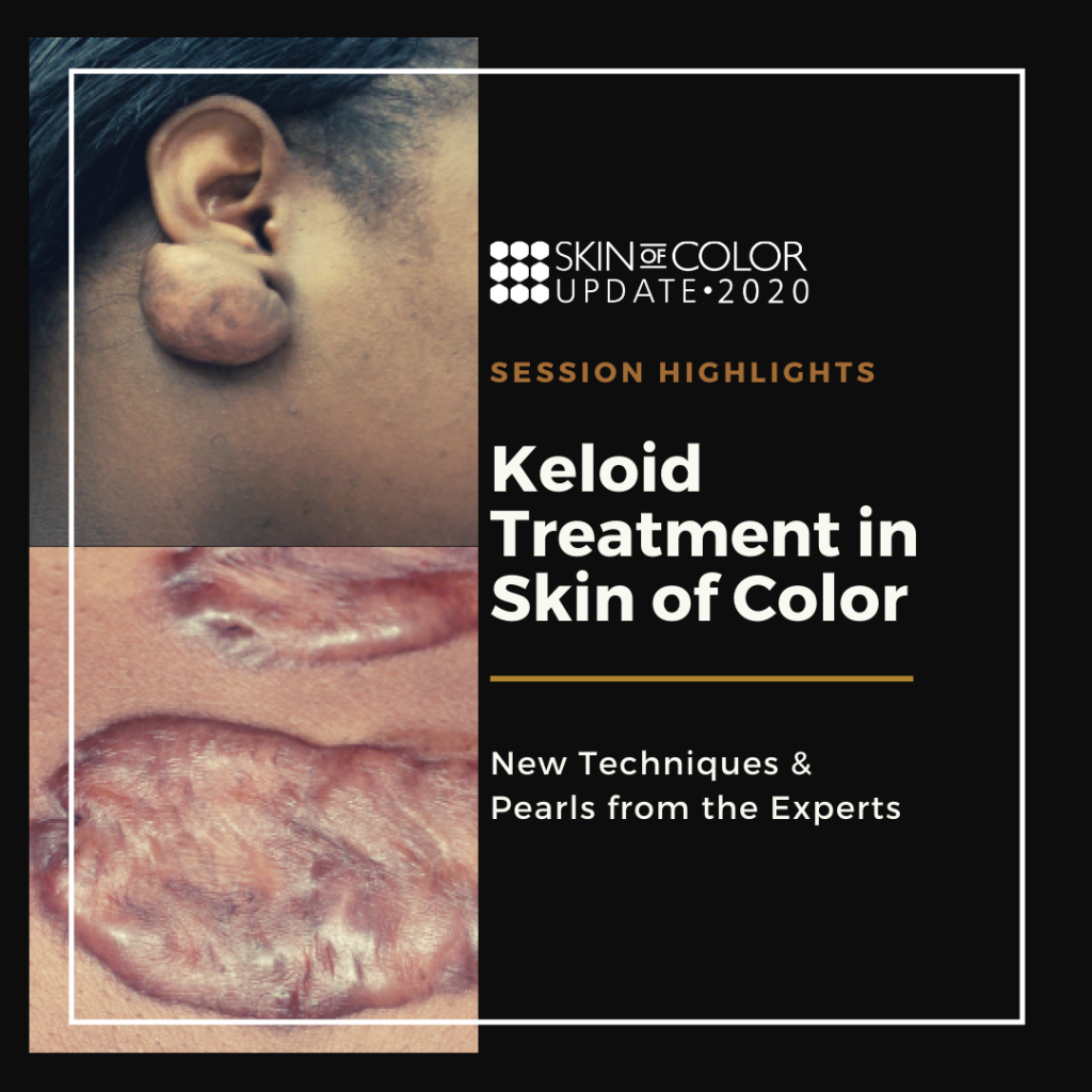 latest research on keloid
