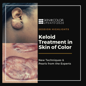 Keloid in SOC