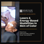 lasers for skin of color
