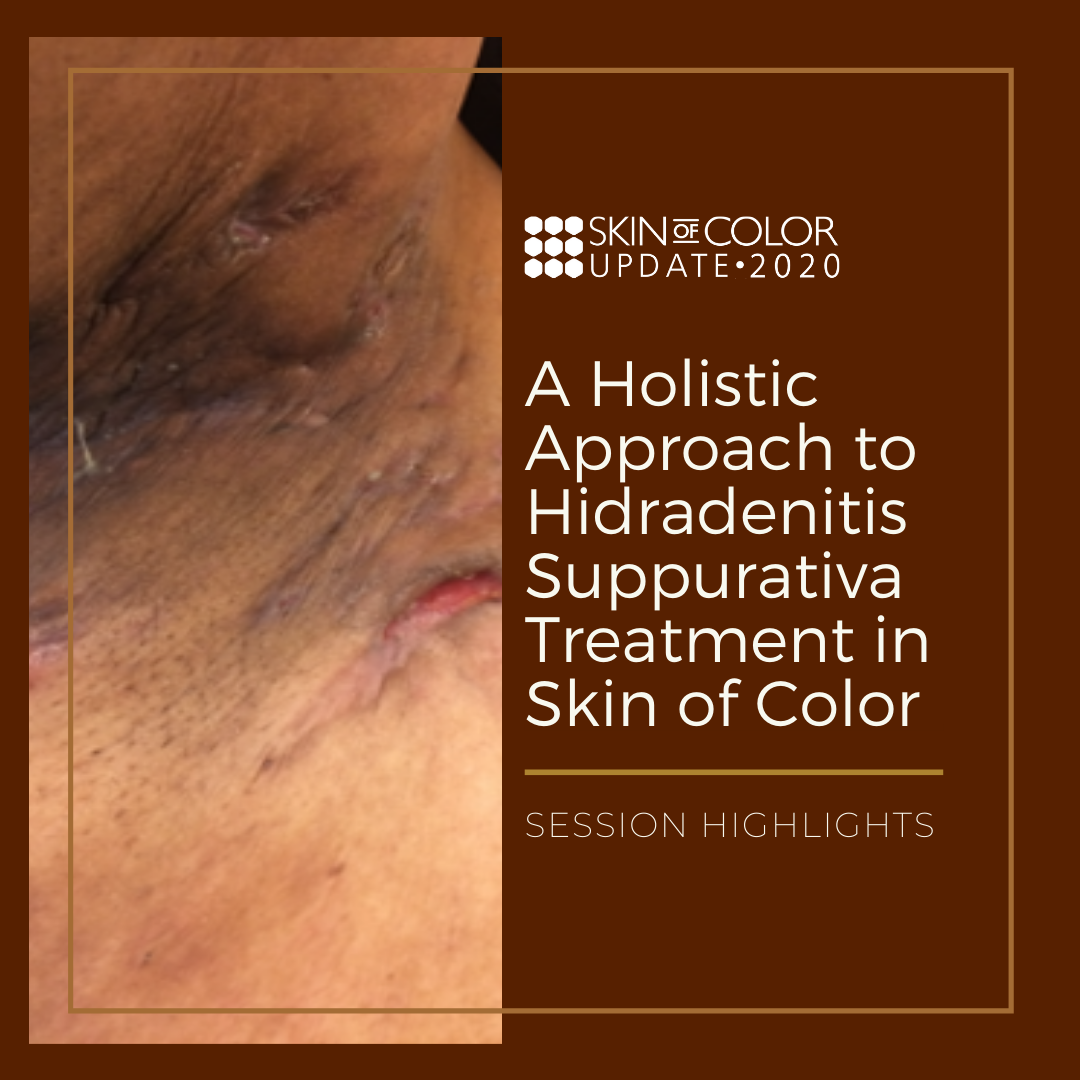 A Holistic Approach to Hidradenitis Suppurativa Treatment in Skin of Color