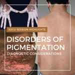 disorders of pigmentation