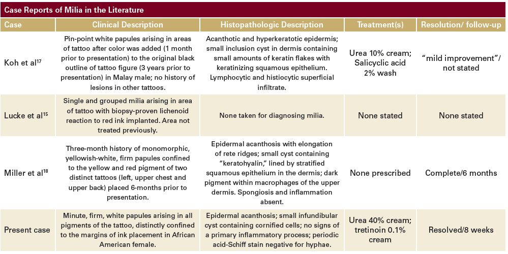 Eruptive Milia Within a Tattoo Next Steps in Dermatology