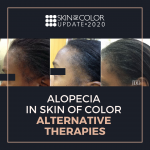 Alopecia in Skin of Color