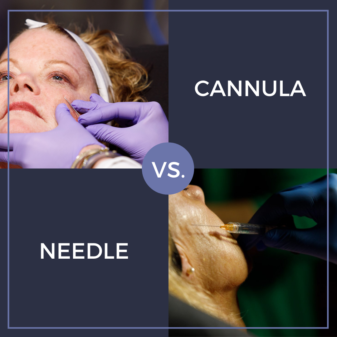 cannula vs. needle