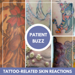 Tattoo-related skin reactions
