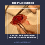 pinch stitch