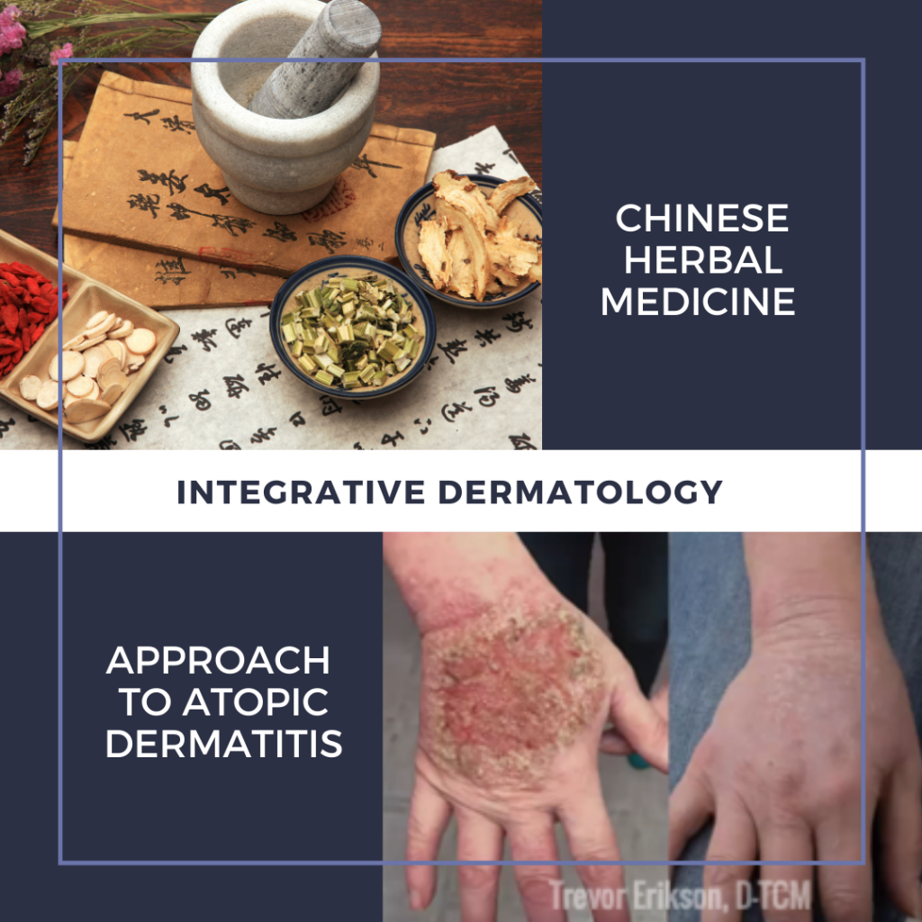 Treatment of Atopic Dermatitis with Chinese Herbal Medicine Next