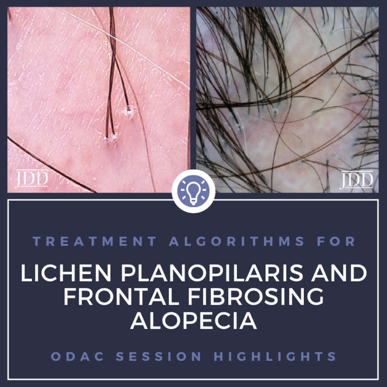 Lichen Planopilaris and Frontal Fibrosing Alopecia Treatment