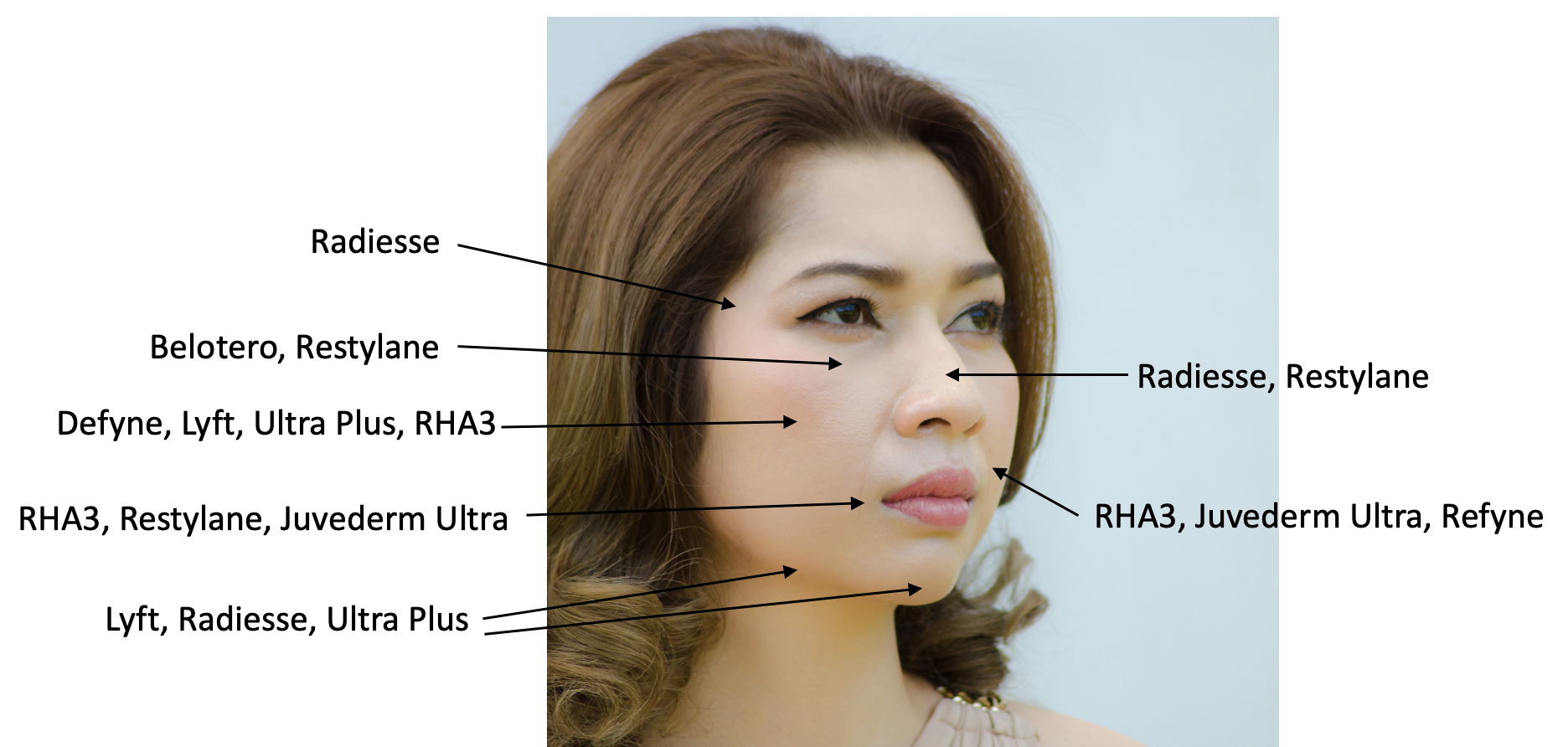 Soft tissue filler options for Asian patients