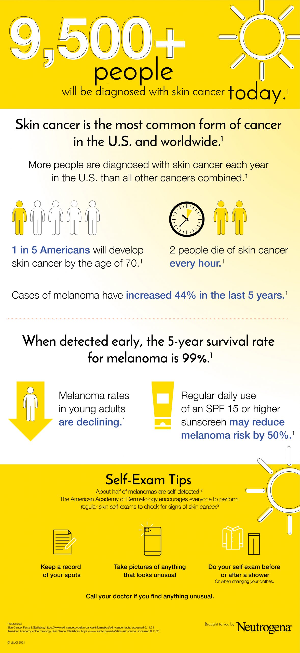 melanoma