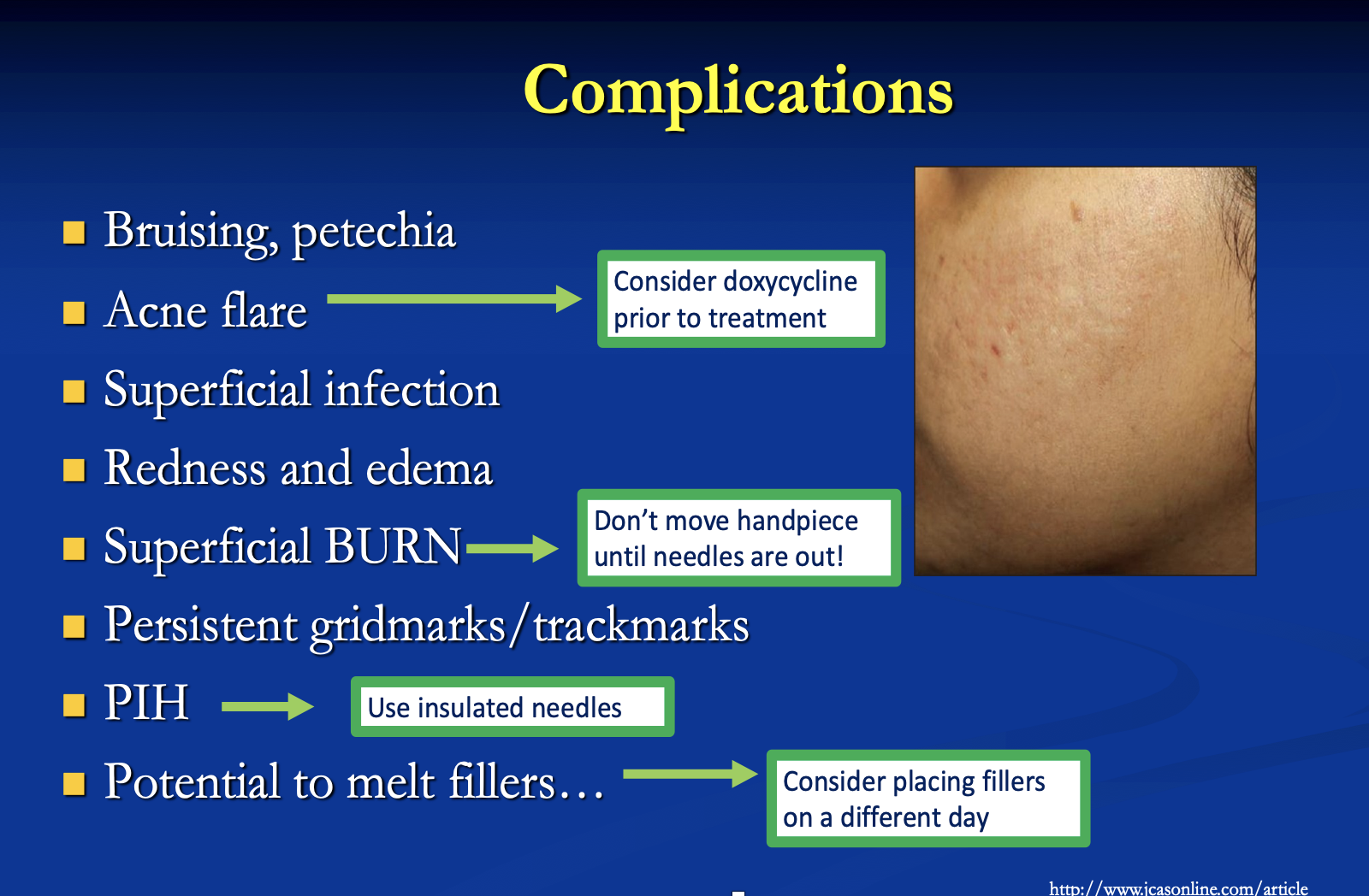 RF Microneedling Complications