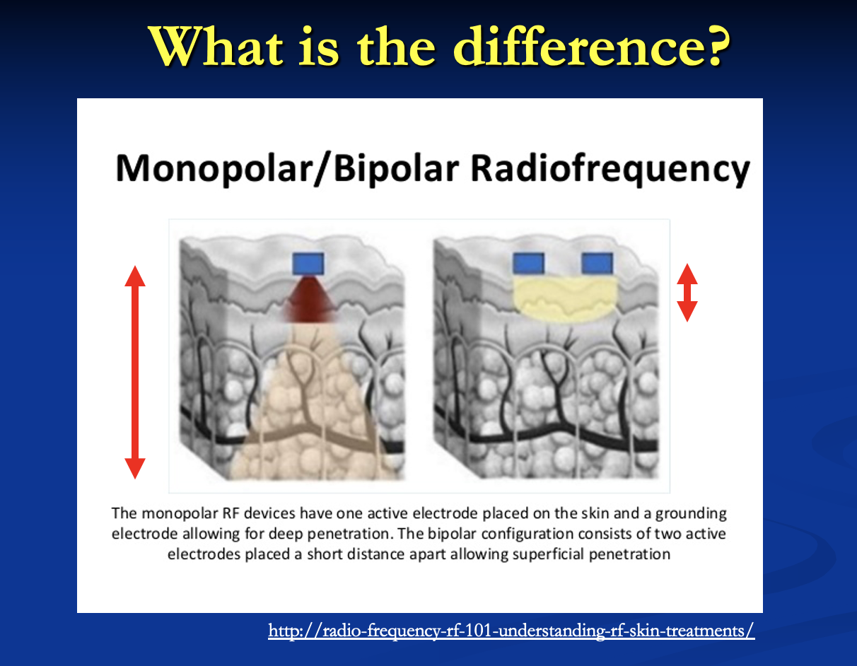 Radio-frequency (RF) Technology for Aesthetic Treatments