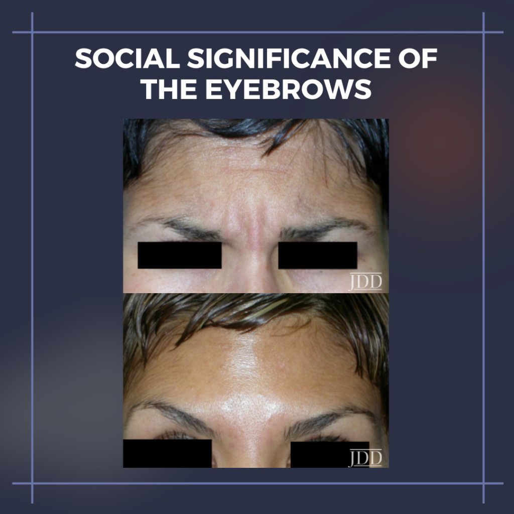 Social Significance of the Eyebrows and Periorbital Complex Next
