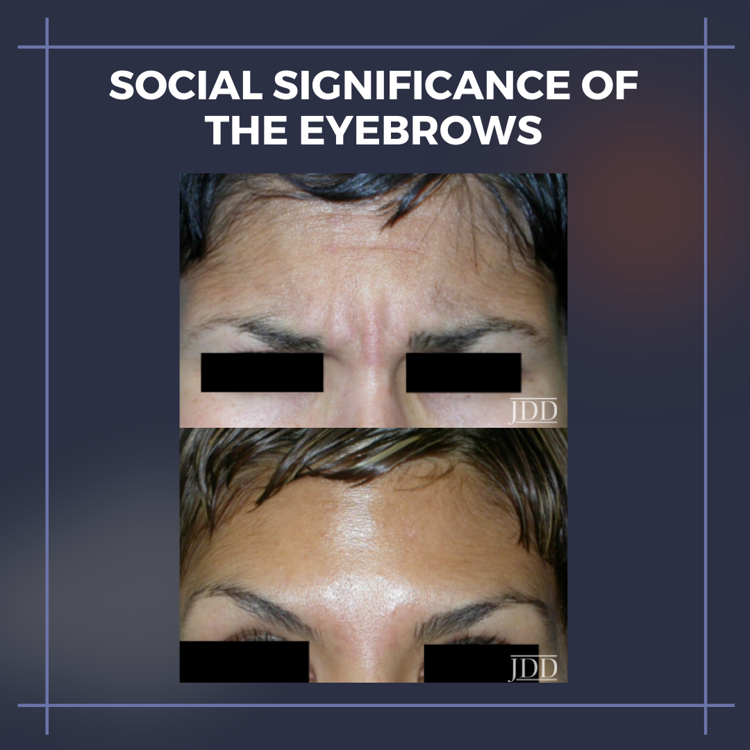 Social Significance of the Eyebrows and Periorbital Complex - Next Steps in  Dermatology