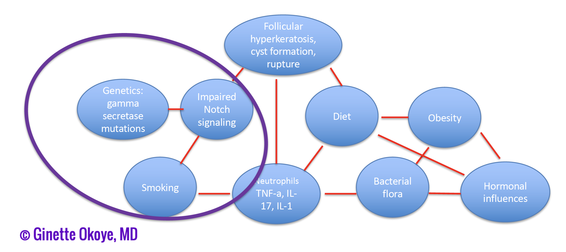 Pathogenesis of follicular subtype of HS