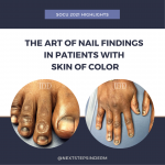 nail findings