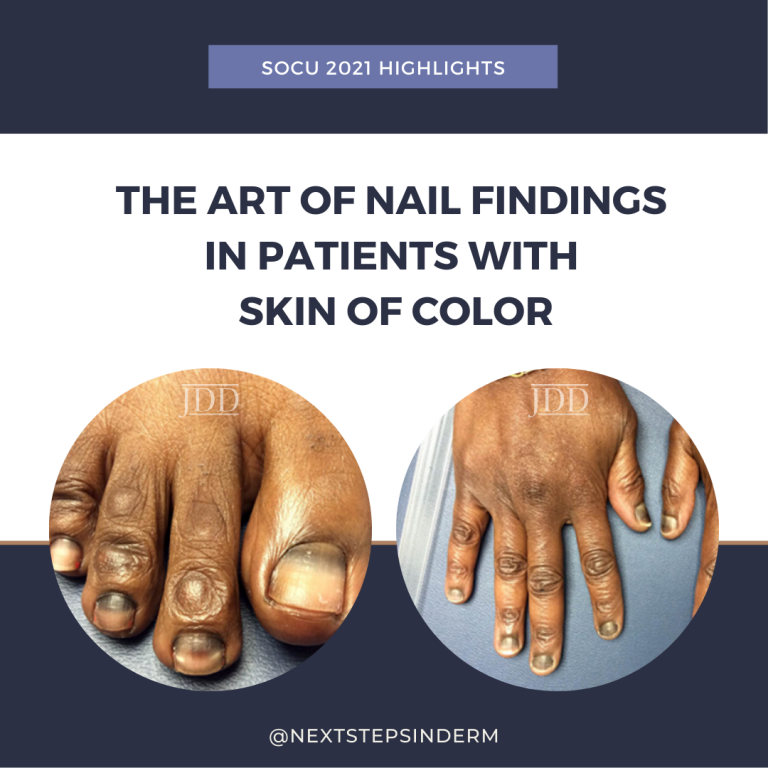 nail matrix biopsy Next Steps in Dermatology