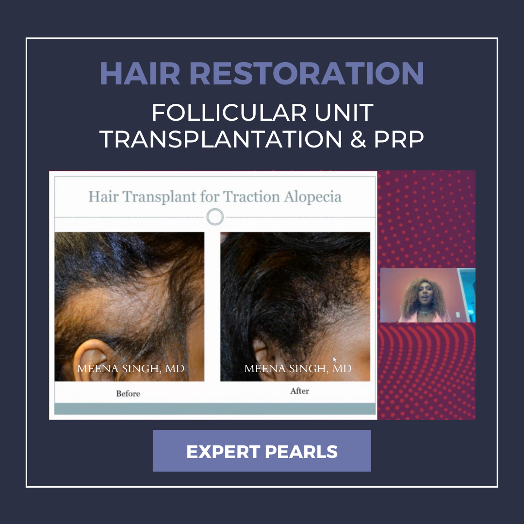 Hair Restoration: Follicular Unit Transplantation & PRP - Next Steps in  Dermatology
