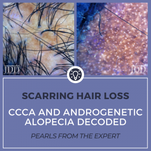 Scarring Hair Loss: CCCA and Androgenetic Alopecia Decoded - Next Steps ...