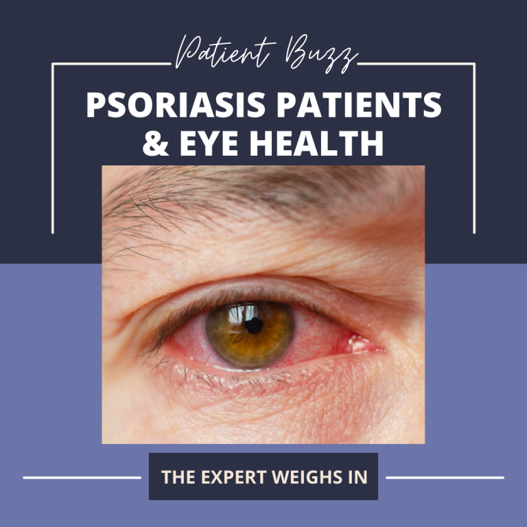 Patient Buzz Psoriasis Patients & Eye Health Next Steps in Dermatology