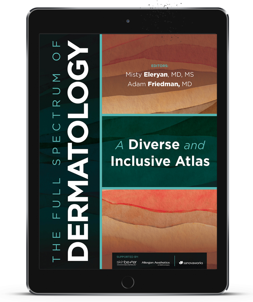 For Sale Now!  Digital Edition of The Full Spectrum of Dermatology: A Diverse and Inclusive Atlas
