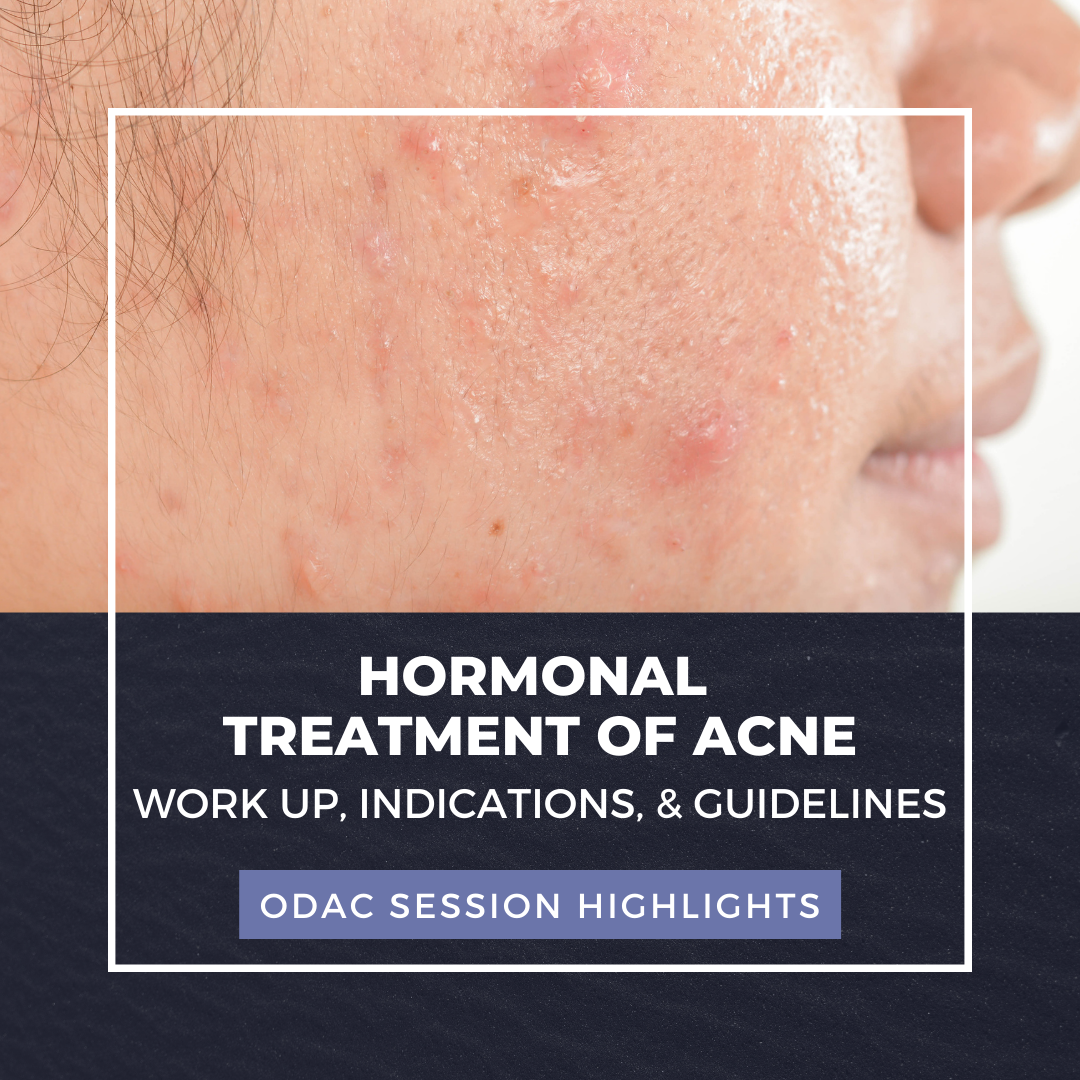 Hormonal Treatment Of Acne Work Up Indications Guidelines Next 