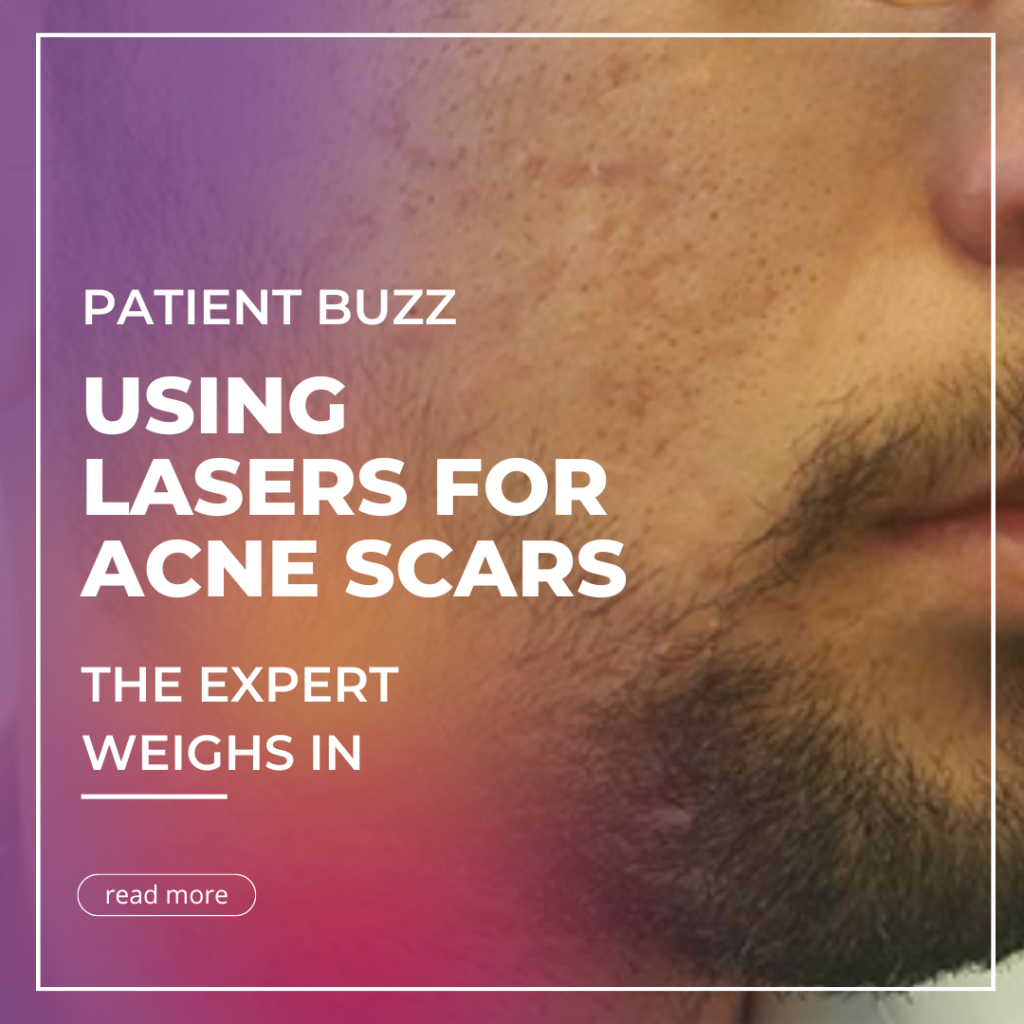 Patient Buzz Using Lasers for Acne Scars The Expert Weighs In Next