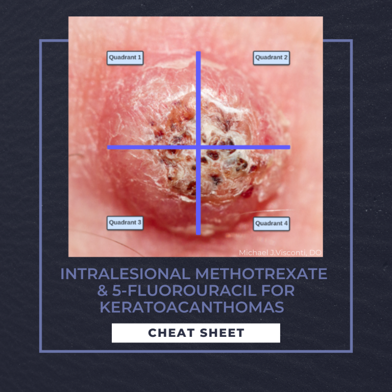 Intralesional Methotrexate & 5Fluorouracil for Keratoacanthomas