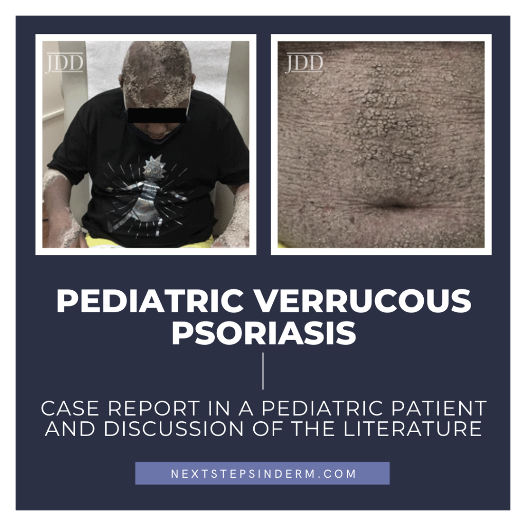 Pediatric Verrucous Psoriasis