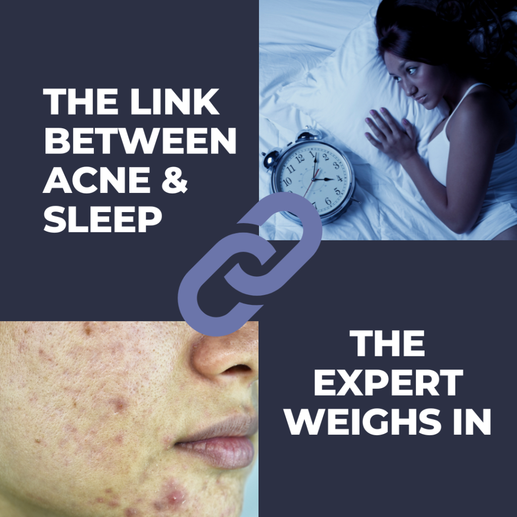 The Link Between Acne And Sleep | The Expert Weighs In - Next Steps In ...