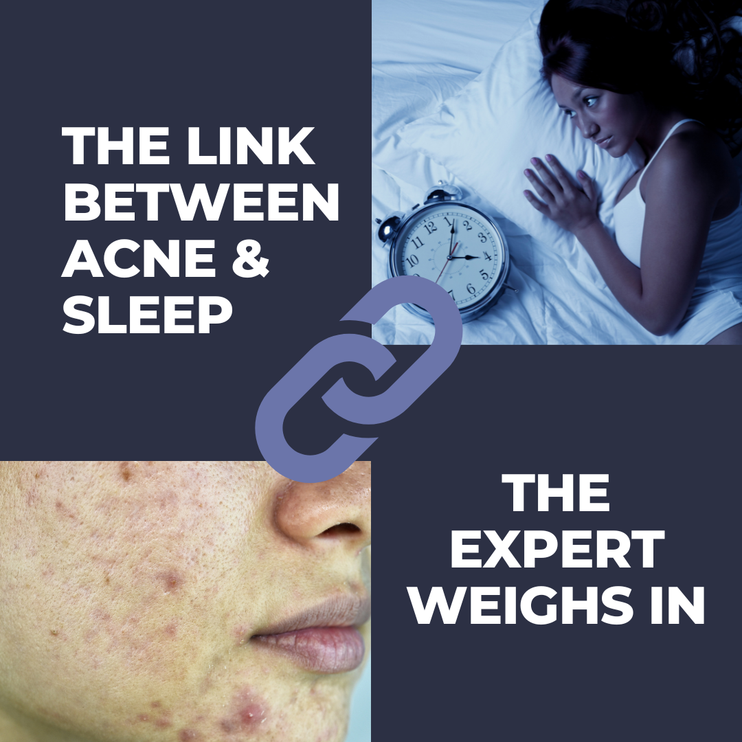 acne and sleep