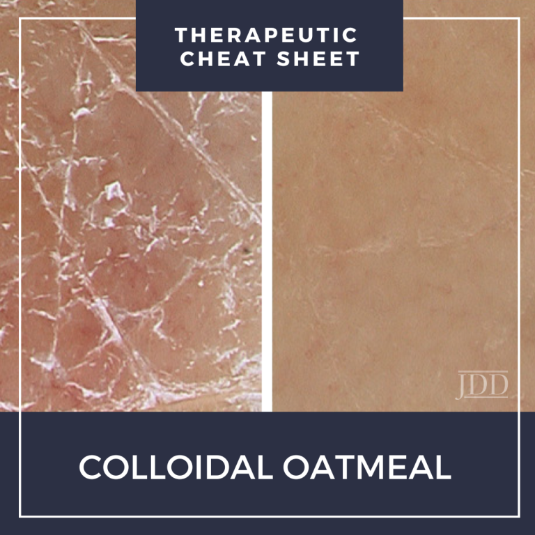 COLLOIDAL OATMEAL CHEAT SHEET Next Steps in Dermatology