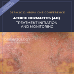 atopic dermatitis (AD)