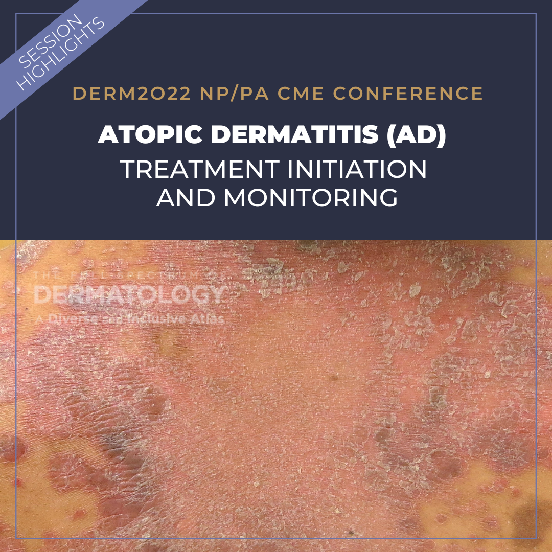 atopic dermatitis (AD)