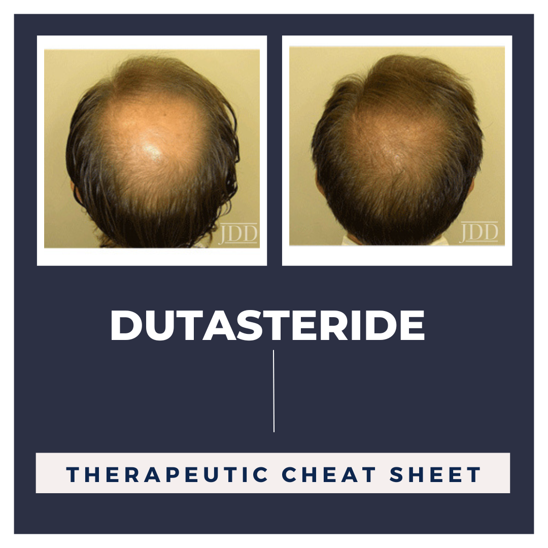 Dutasteride Therapeutic Cheat Sheet - Next Steps in Dermatology