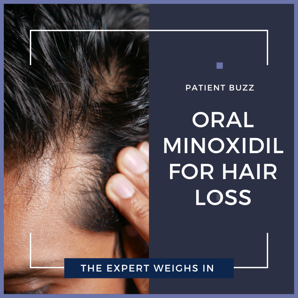 Oral Minoxidil For Hair Loss | The Expert Weighs In - Next Steps In ...