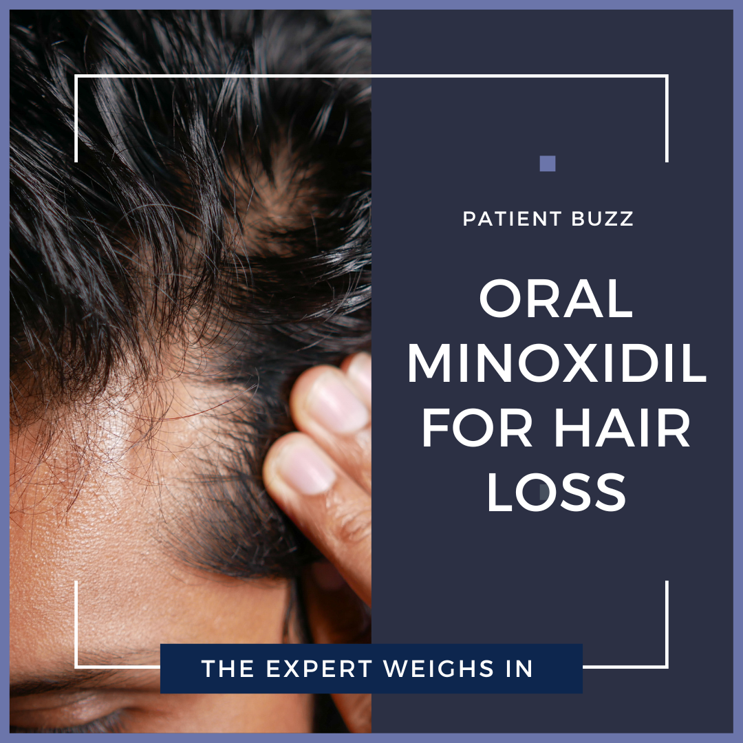 oral minoxidil for hair loss