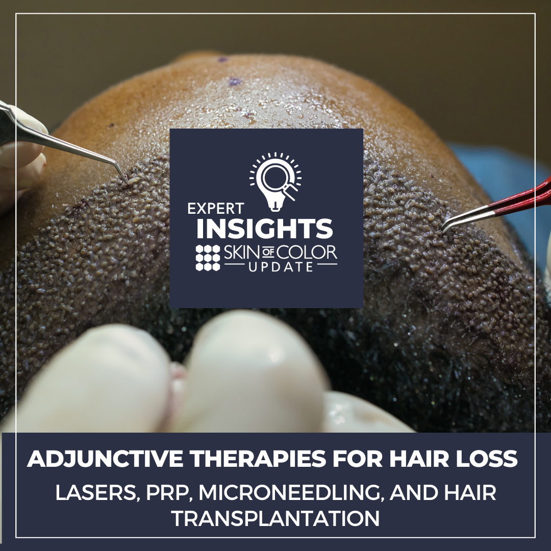 adjunctive therapies for hair loss